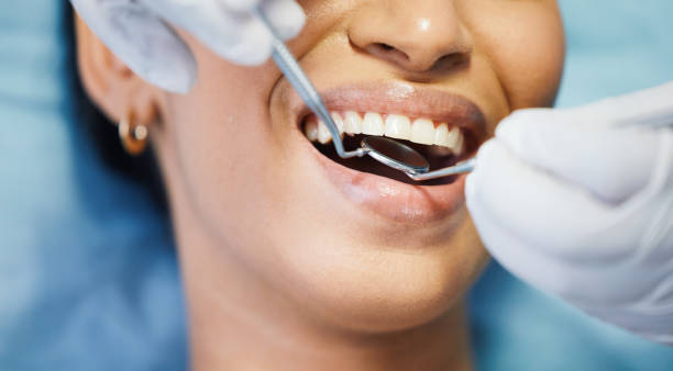 Best Broken or Cracked Tooth Emergency Dentist in Yuipa, CA